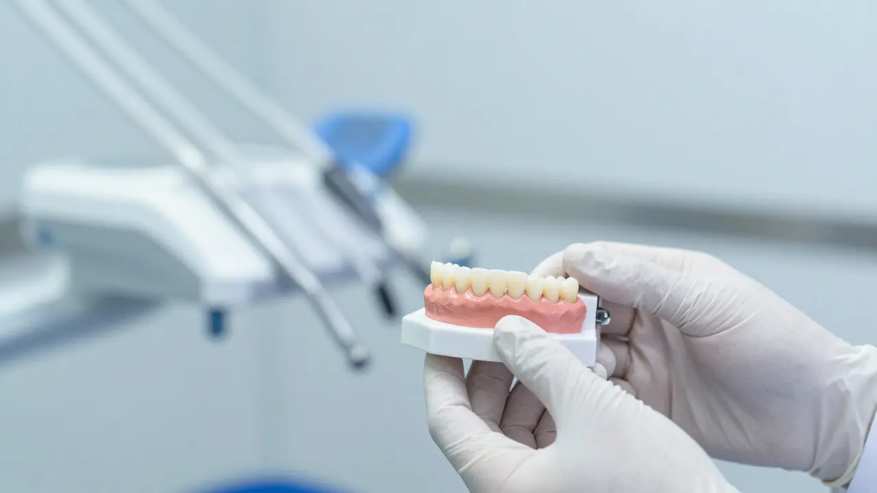 Kolik stojí můstek na 3 zuby? Ceny, materiály a co vás čeká v ordinaci